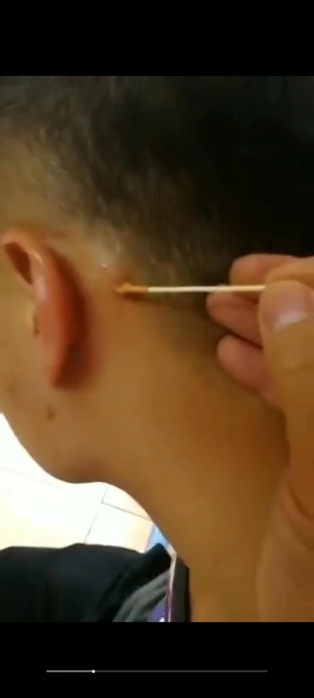 图片[3]-痣祛‬点痣方法（视频+药方）-真传国学