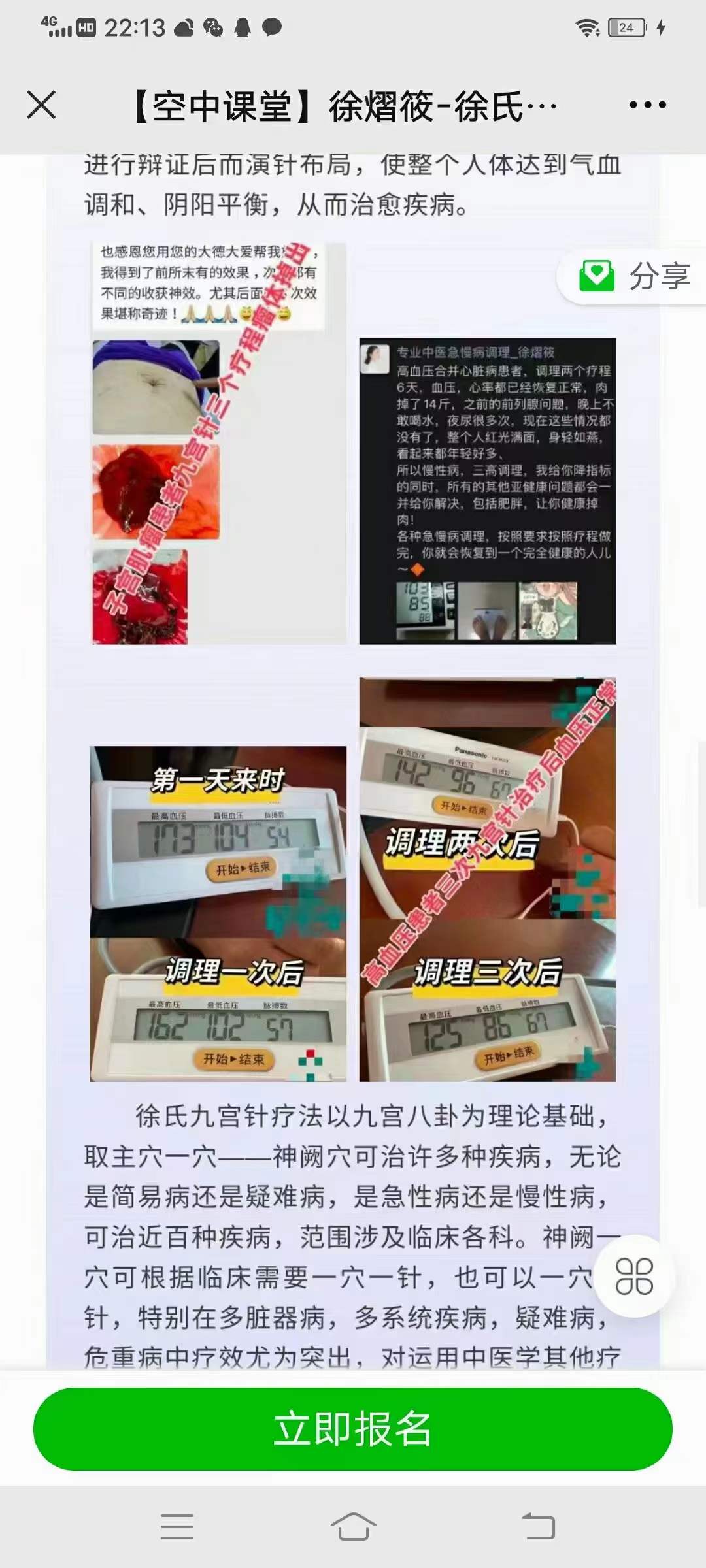 图片[2]-徐熠筱 九宫针疗法临床技术-真传国学